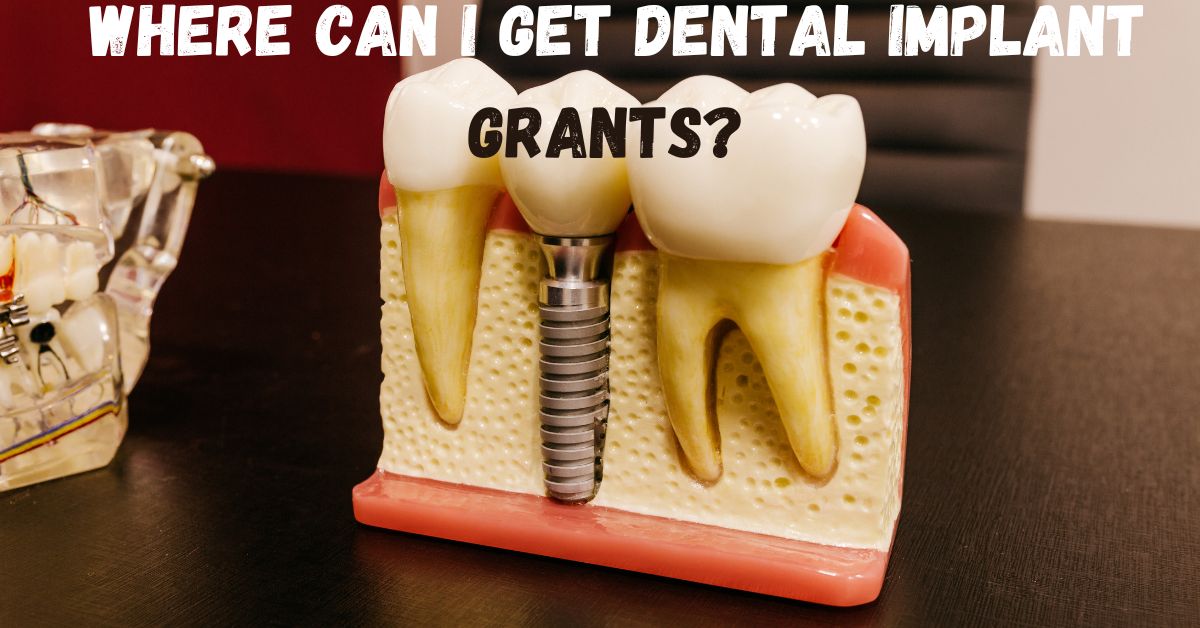 Dental Implant Grants